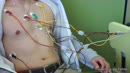 Thumbnail - Finden Sie die Fehler_12-Kanal-EKG